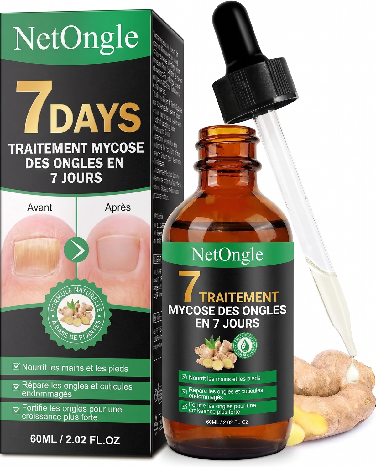 NetOngle — Traitement Anti-Mycose, Protocole Complet