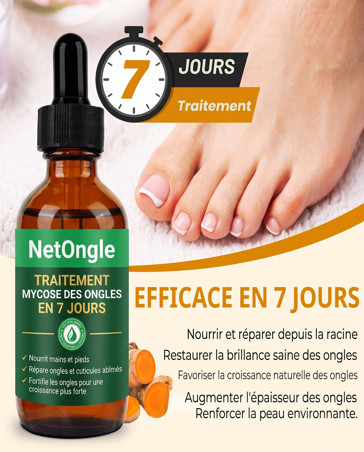 NetOngle — Traitement Anti-Mycose, Protocole Complet